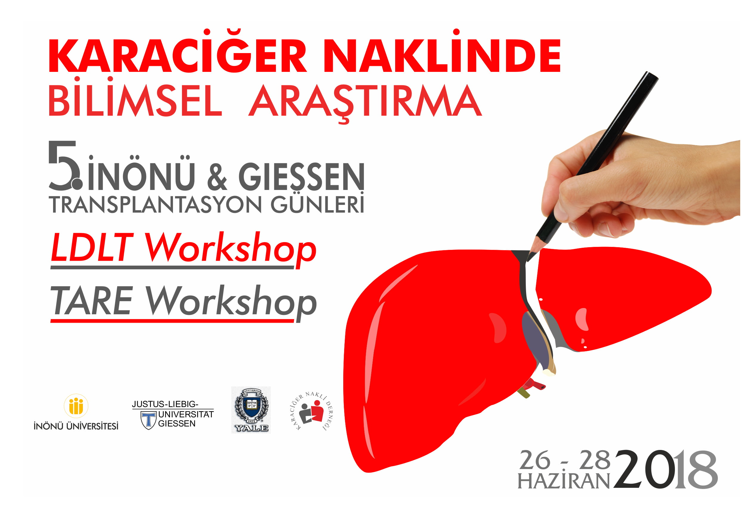 2018.05.22 kongre karaciğer nakli copy